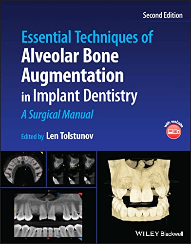 Essential Techniques of Alveolar Bone Augmentation in Implant Dentistry: A Surgical Manual, 2nd Edition (Original PDF from Publisher)