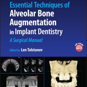 Essential Techniques of Alveolar Bone Augmentation in Implant Dentistry: A Surgical Manual, 2nd Edition (EPUB)