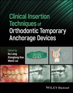 Clinical Insertion Techniques of Orthodontic Temporary Anchorage Devices (EPUB)