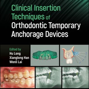 Clinical Insertion Techniques of Orthodontic Temporary Anchorage Devices (EPUB)