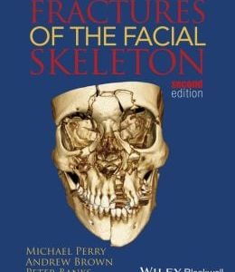 Fractures of the Facial Skeleton, 2nd Edition