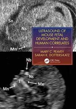 Ultrasound of Mouse Fetal Development and Human Correlates (Reproductive Medicine and Assisted Reproductive Techniques Series) (Original PDF from Publisher)