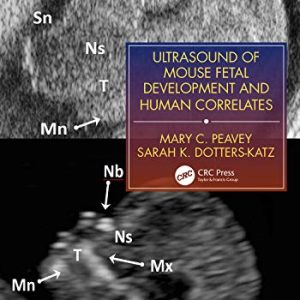 Ultrasound of Mouse Fetal Development and Human Correlates (Reproductive Medicine and Assisted Reproductive Techniques Series) (Original PDF from Publisher)