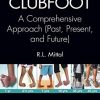 Clubfoot: A Comprehensive Approach (Past, Present, and Future) (PDF)