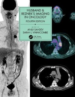 Husband & Reznek’s Imaging in Oncology, 4th edition (Original PDF from Publisher)