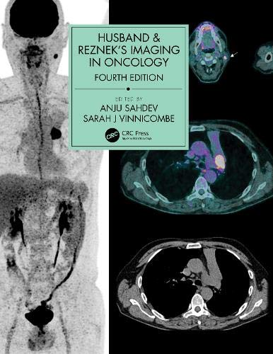 Husband & Reznek’s Imaging in Oncology, 4th edition (ePub)
