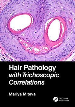 Hair Pathology with Trichoscopic Correlations (Original PDF from Publisher)