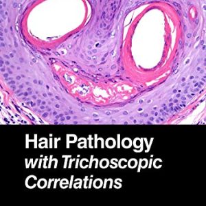 Hair Pathology with Trichoscopic Correlations (Original PDF from Publisher)