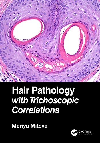 Hair Pathology with Trichoscopic Correlations (Original PDF from Publisher)