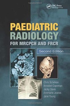 Paediatric Radiology for MRCPCH and FRCR, Second Edition (Original PDF from Publisher)
