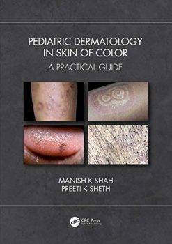 Pediatric Dermatology in Skin of Color: A Practical Guide (Original PDF from Publisher)