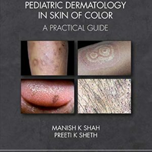 Pediatric Dermatology in Skin of Color: A Practical Guide (Original PDF from Publisher)