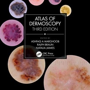 Atlas of Dermoscopy: Third Edition (EPUB)