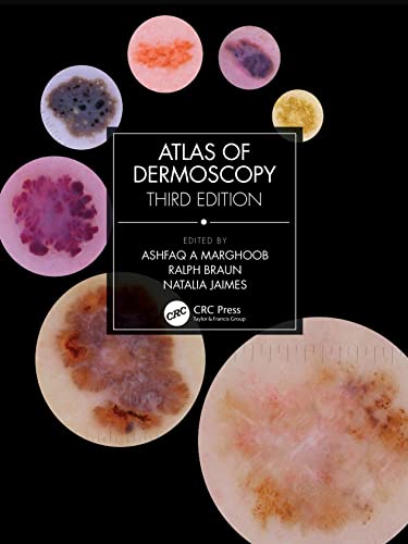 Atlas of Dermoscopy: Third Edition (EPUB)