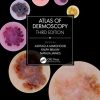 Atlas of Dermoscopy: Third Edition (Original PDF from Publisher)