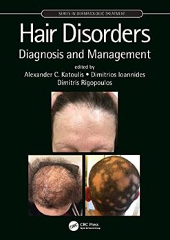 Hair Disorders: Diagnosis and Management (Series in Dermatological Treatment) (Original PDF from Publisher)