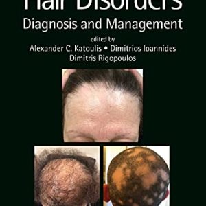 Hair Disorders: Diagnosis and Management (Series in Dermatological Treatment) (Original PDF from Publisher)