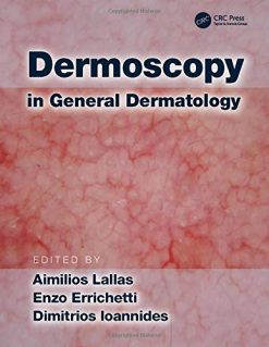 Dermoscopy in General Dermatology (PDF)