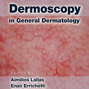 Dermoscopy in General Dermatology (PDF)