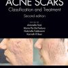 Acne Scars: Classification and Treatment, 2ed (PDF)