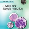 Thyroid Fine Needle Aspiration (Original PDF from Publisher)