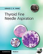 Thyroid Fine Needle Aspiration (Original PDF from Publisher)