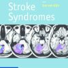 Stroke Syndromes, 3e (Original PDF from Publisher)