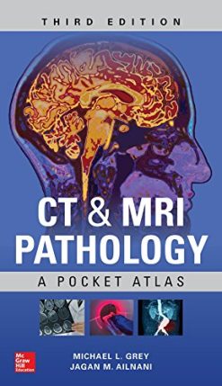 CT & MRI Pathology: A Pocket Atlas, Third Edition (EPUB)