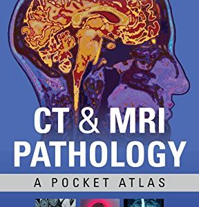 CT & MRI Pathology: A Pocket Atlas, Third Edition (EPUB)