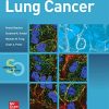 Lung Cancer: Standards of Care (Original PDF from Publisher)
