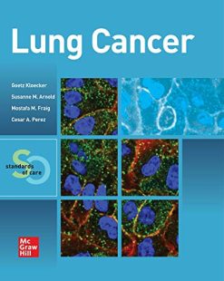 Lung Cancer: Standards of Care (Original PDF from Publisher)
