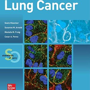 Lung Cancer: Standards of Care (Original PDF from Publisher)
