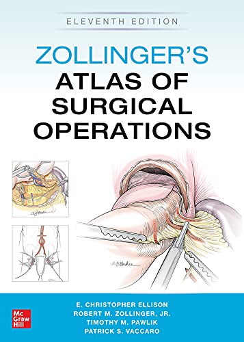 Zollinger’s Atlas of Surgical Operations, Eleventh Edition (True PDF)