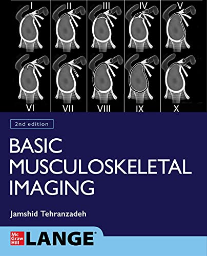 Basic Musculoskeletal Imaging, Second Edition (Original PDF from Publisher)