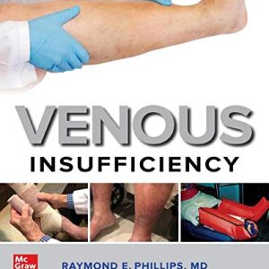 Venous Insufficiency (EPUB)