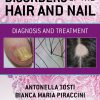 Disorders of the Hair and Nail: Diagnosis and Treatment (Original PDF from Publisher)