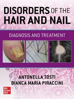 Disorders of the Hair and Nail: Diagnosis and Treatment (Original PDF from Publisher)