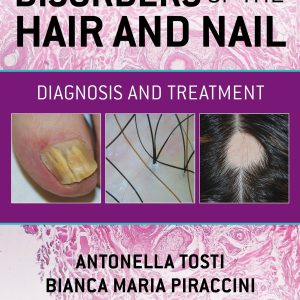 Disorders of the Hair and Nail: Diagnosis and Treatment (Original PDF from Publisher)