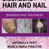 Disorders of the Hair and Nail: Diagnosis and Treatment (EPUB)