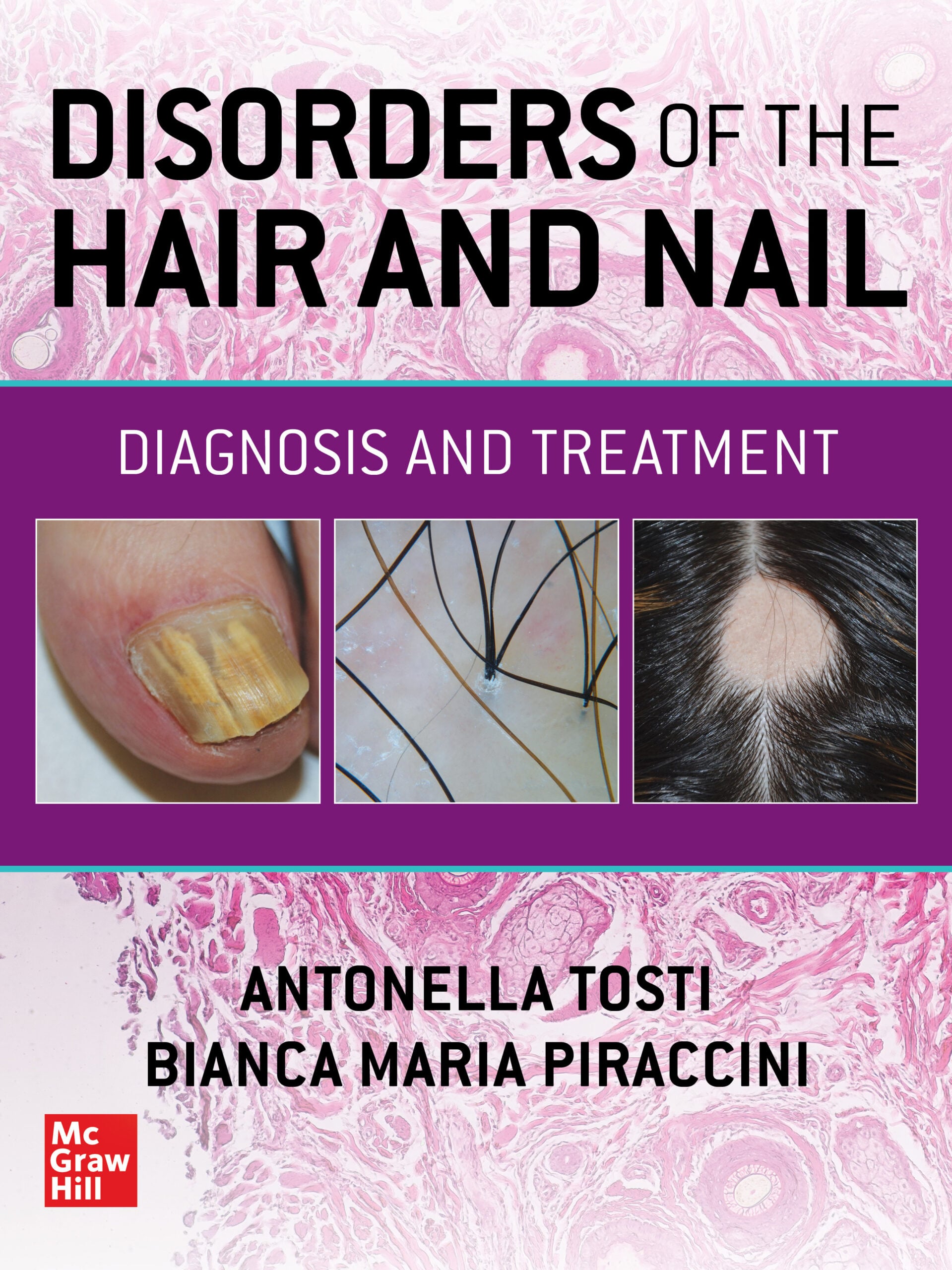 Disorders of the Hair and Nail: Diagnosis and Treatment (EPUB)