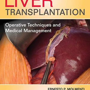 Liver Transplantation: Operative Techniques and Medical Management (Original PDF from Publisher)