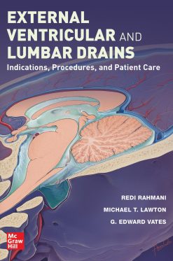 External Ventricular and Lumbar Drains: Indications, Procedures, and Patient Care (Original PDF from Publisher)