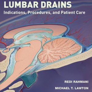 External Ventricular and Lumbar Drains: Indications, Procedures, and Patient Care (EPUB)