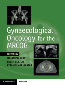 Gynaecological Oncology for the MRCOG (PDF)