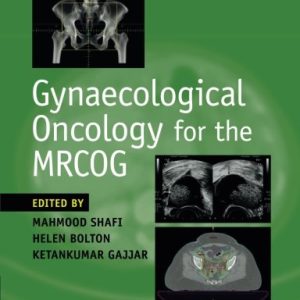 Gynaecological Oncology for the MRCOG (PDF)