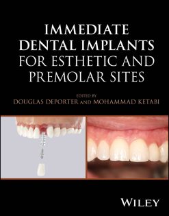Immediate Dental Implants for Esthetic and Premolar Sites (EPUB)