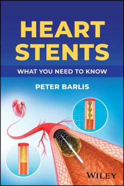 Heart Stents (EPUB)
