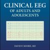 Clinical EEG of Adults and Adolescents (EPUB)