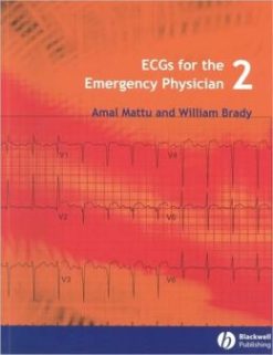 ECGs for the Emergency Physician 2