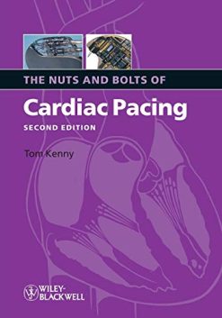 The Nuts and Bolts of Cardiac Pacing, 2nd Edition (EPUB)